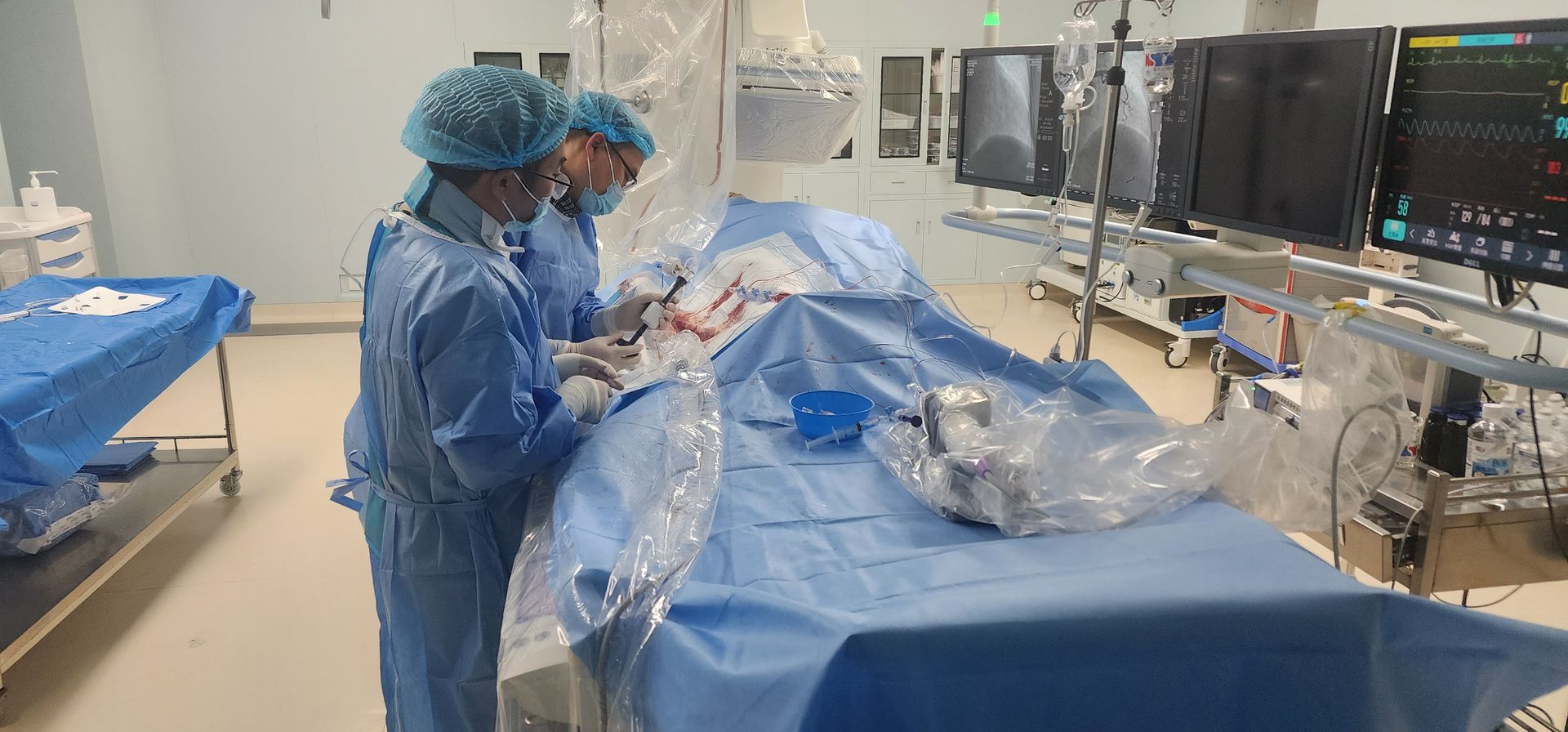 Case Sharing | Vesscrack Coronary IVL Balloon for Severe Calcified Lesion Treatment