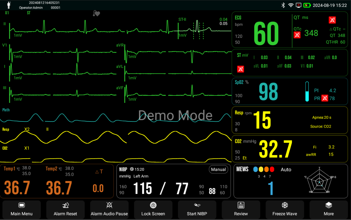 datatypefor datafanyifanyiHRV analysis ST and QT analysis